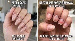 Comparison showing healthy manicured nails on one side and damaged natural nails from improper removal on the other.