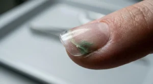 A close-up shot of a nail lifting at the edge with visible green discoloration due to trapped moisture and bacteria.